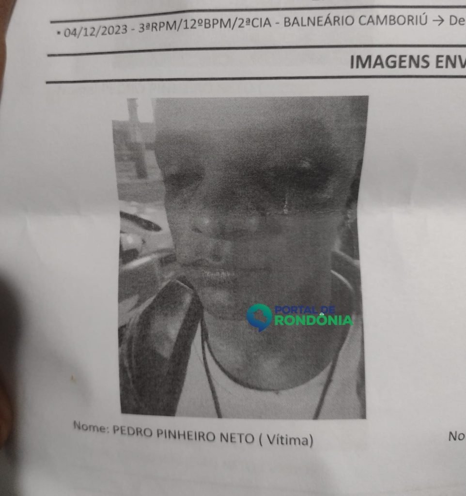 WhatsApp-Image-2023-12-12-at-12.34.32-1-962x1024 Cantor rondoniense é espancado por três homens em Balneário Camboriú