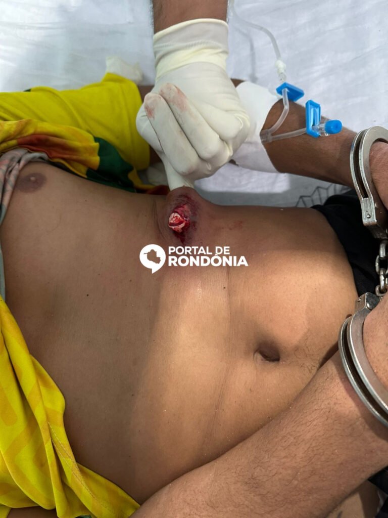 761476D3-4F0A-4DDC-8842-01FD8E932403-768x1024 Assaltante de banco é atingido a tiros em confronto com a Polícia Militar