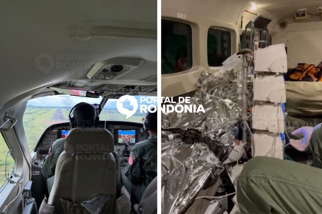 WhatsApp-Image-2026-03-16-at-08.28.47-1-1-1024x682 Criança atingida no rosto por hélice de embarcação é transferida em estado grave para Porto Velho