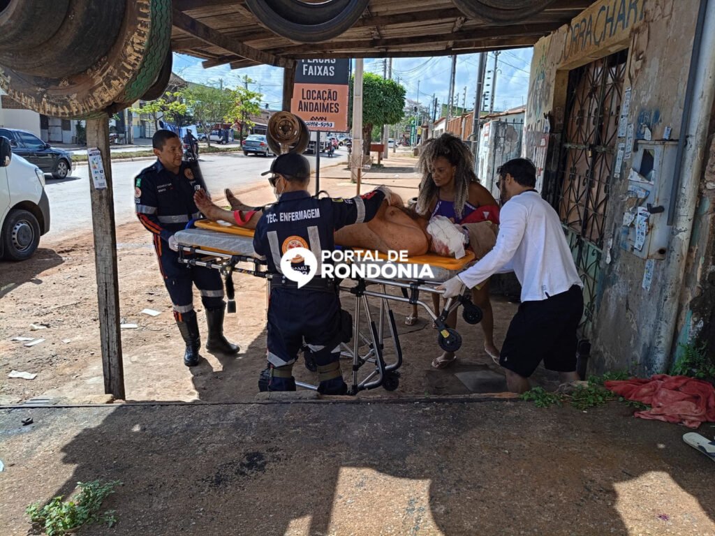 DB4AAB27-0149-422E-83D9-3F2CB506E650-1024x768 Padrasto é atacado a facadas na cabeça por enteado após discussão na zona leste